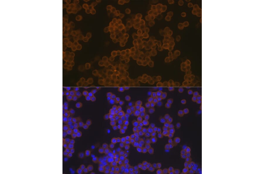 Immunofluorescence - Anti-PLCG 2 Antibody [ARC1176] (A308453) - Antibodies.com