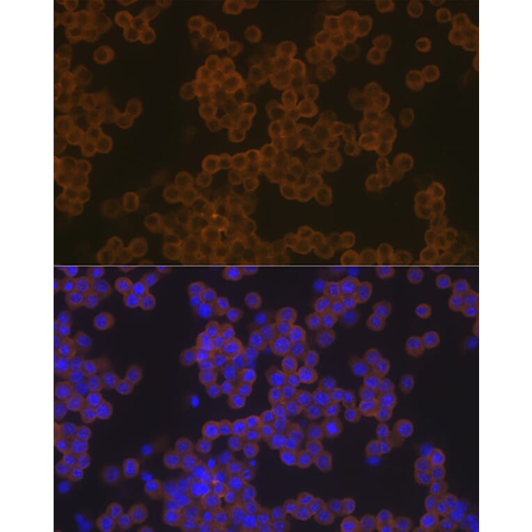 Immunofluorescence - Anti-PLCG 2 Antibody [ARC1176] (A308453) - Antibodies.com