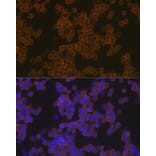 Immunofluorescence - Anti-PLCG 2 Antibody [ARC1176] (A308453) - Antibodies.com