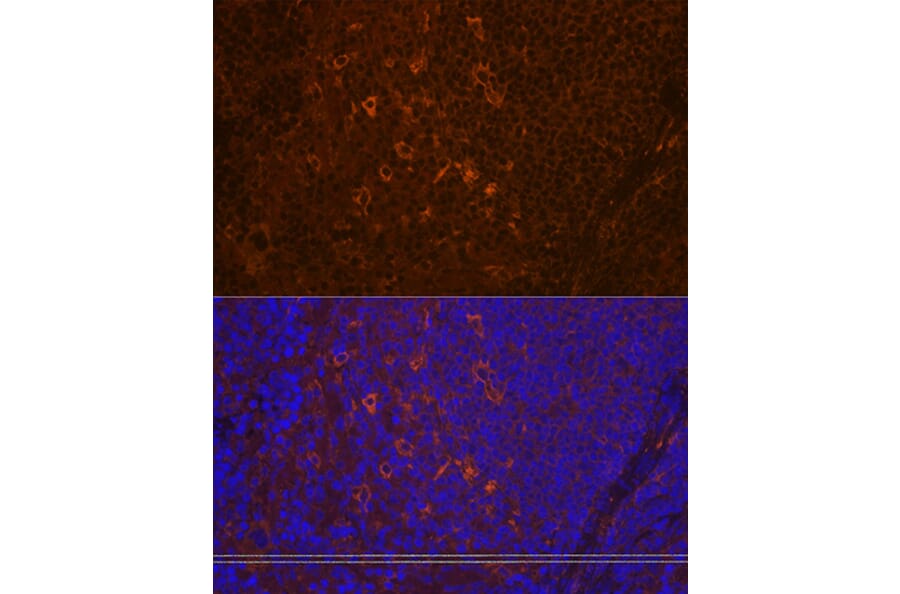 Immunofluorescence - Anti-PLCG 2 Antibody [ARC1176] (A308453) - Antibodies.com