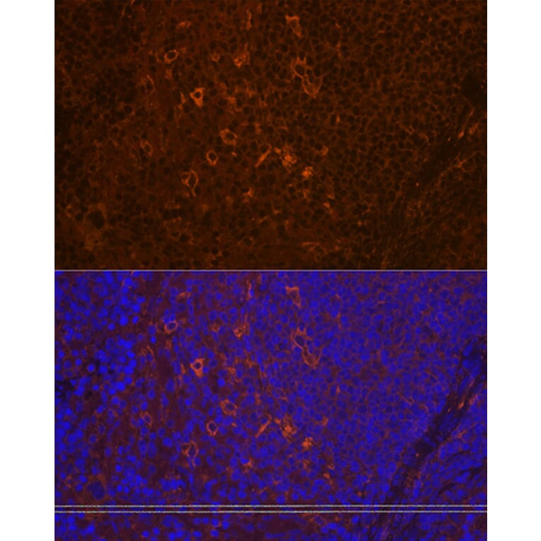 Immunofluorescence - Anti-PLCG 2 Antibody [ARC1176] (A308453) - Antibodies.com