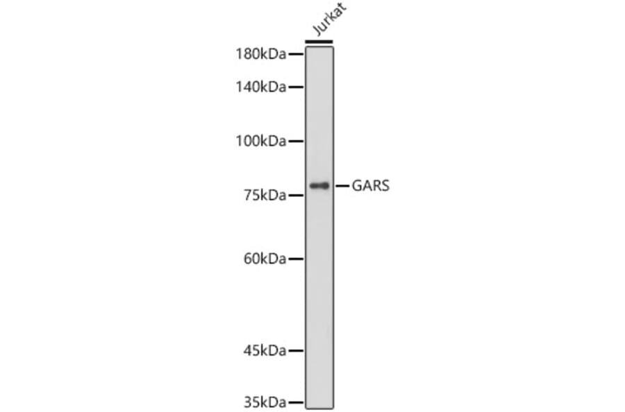 Western Blot - Anti-GARS Antibody [ARC0514] (A308454) - Antibodies.com