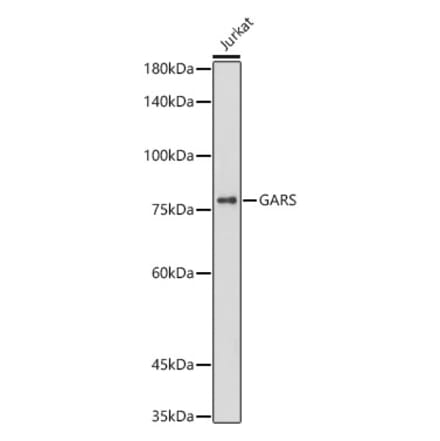 Western Blot - Anti-GARS Antibody [ARC0514] (A308454) - Antibodies.com