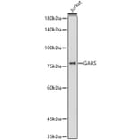 Western Blot - Anti-GARS Antibody [ARC0514] (A308454) - Antibodies.com