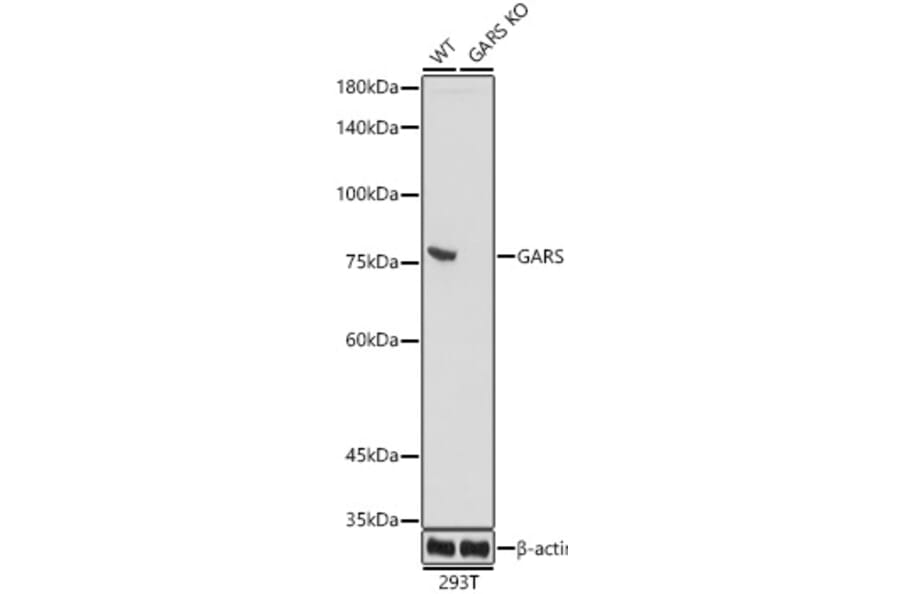 Western Blot - Anti-GARS Antibody [ARC0514] (A308454) - Antibodies.com