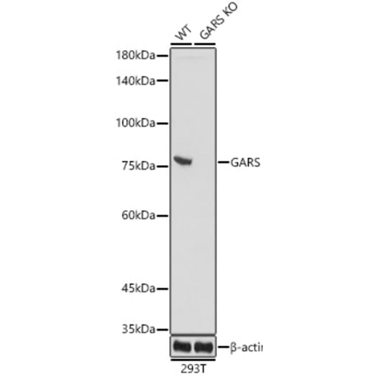 Western Blot - Anti-GARS Antibody [ARC0514] (A308454) - Antibodies.com