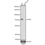 Western Blot - Anti-GARS Antibody [ARC0514] (A308454) - Antibodies.com