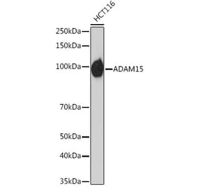 Western Blot - Anti-ADAM15 Antibody [ARC1419] (A308455) - Antibodies.com