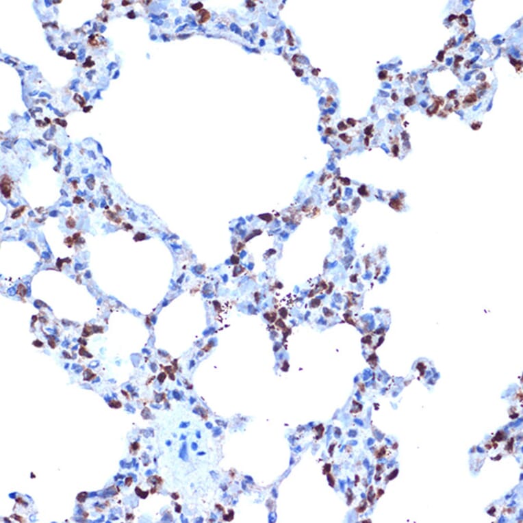 Immunohistochemistry - Anti-ADAM15 Antibody [ARC1419] (A308455) - Antibodies.com