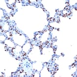 Immunohistochemistry - Anti-ADAM15 Antibody [ARC1419] (A308455) - Antibodies.com