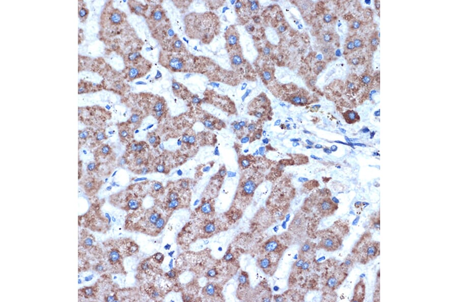 Immunohistochemistry - Anti-ADAM15 Antibody [ARC1419] (A308455) - Antibodies.com