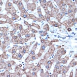 Immunohistochemistry - Anti-ADAM15 Antibody [ARC1419] (A308455) - Antibodies.com