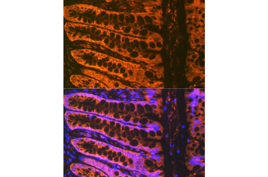 Immunofluorescence - Anti-ADAM15 Antibody [ARC1419] (A308455) - Antibodies.com