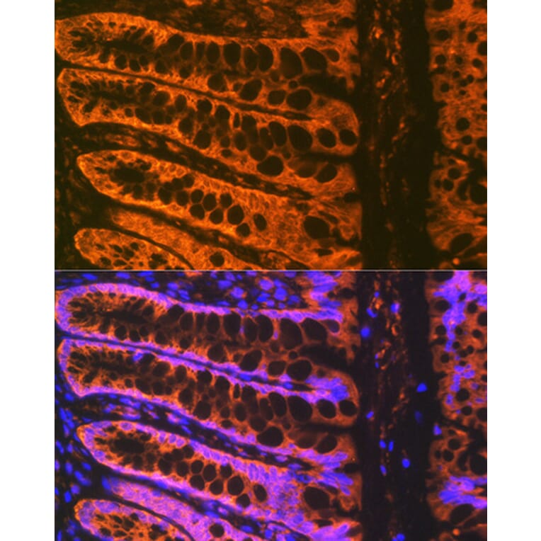 Immunofluorescence - Anti-ADAM15 Antibody [ARC1419] (A308455) - Antibodies.com