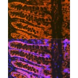 Immunofluorescence - Anti-ADAM15 Antibody [ARC1419] (A308455) - Antibodies.com