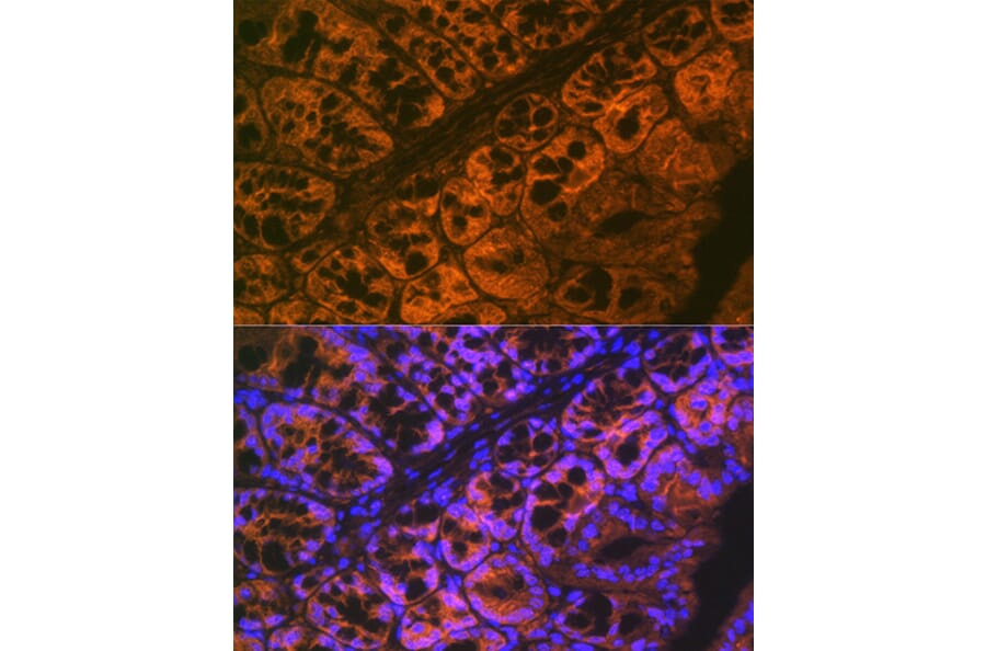 Immunofluorescence - Anti-ADAM15 Antibody [ARC1419] (A308455) - Antibodies.com