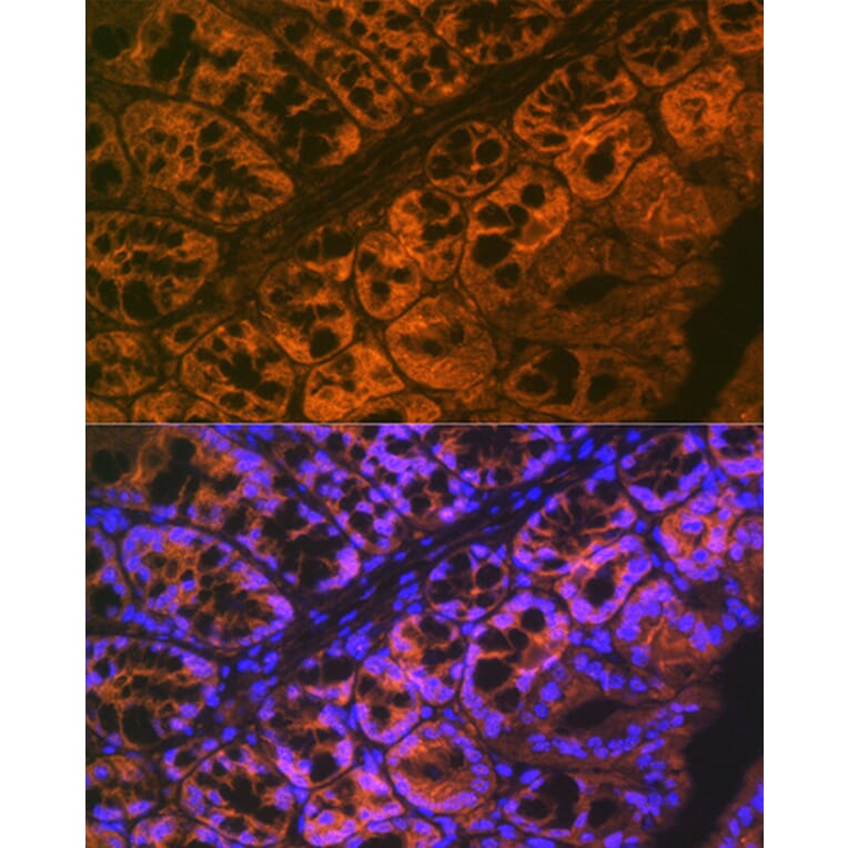 Immunofluorescence - Anti-ADAM15 Antibody [ARC1419] (A308455) - Antibodies.com