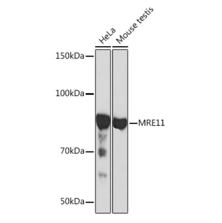 Western Blot - Anti-Mre11 Antibody [ARC0931] (A308456) - Antibodies.com