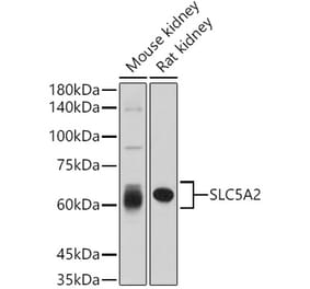 Western Blot - Anti-SGLT2 Antibody (A308462) - Antibodies.com