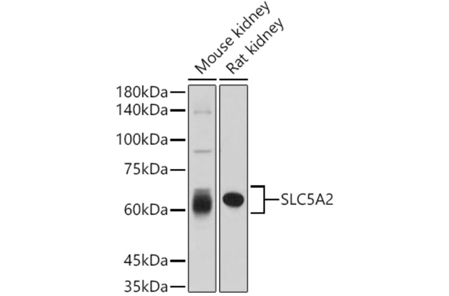 Western Blot - Anti-SGLT2 Antibody (A308462) - Antibodies.com