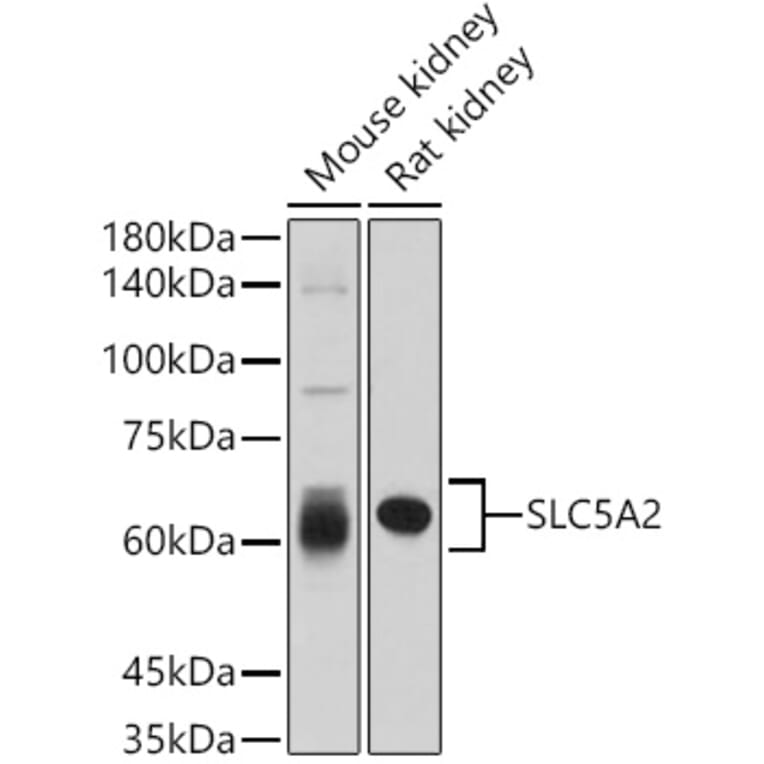 Western Blot - Anti-SGLT2 Antibody (A308462) - Antibodies.com