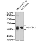 Western Blot - Anti-SGLT2 Antibody (A308462) - Antibodies.com