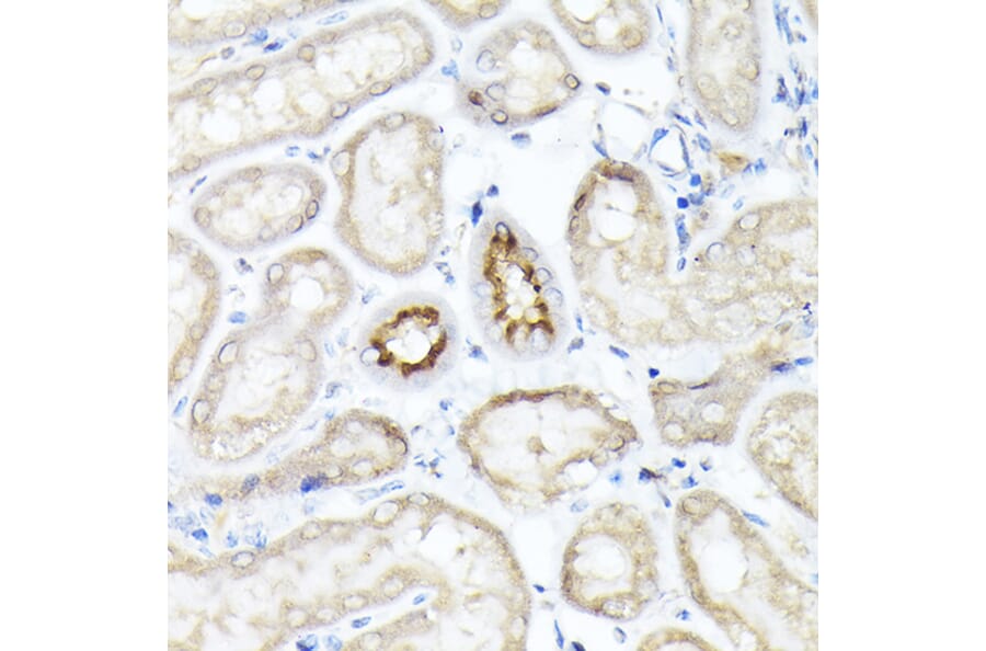 Immunohistochemistry - Anti-SGLT2 Antibody (A308462) - Antibodies.com