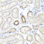 Immunohistochemistry - Anti-SGLT2 Antibody (A308462) - Antibodies.com