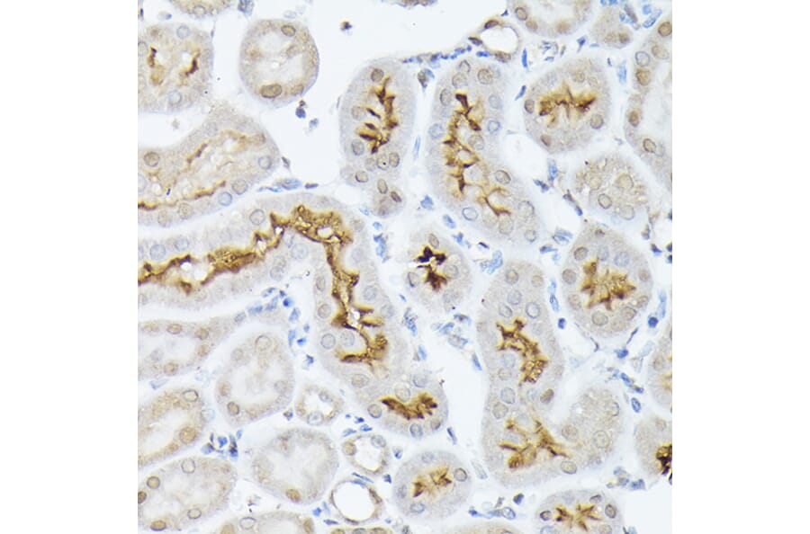 Immunohistochemistry - Anti-SGLT2 Antibody (A308462) - Antibodies.com