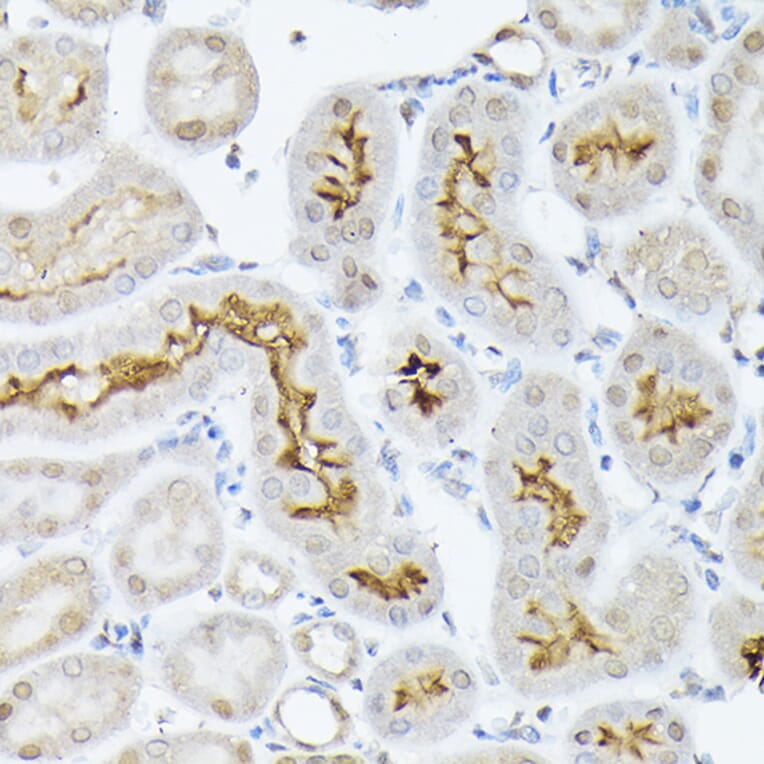 Immunohistochemistry - Anti-SGLT2 Antibody (A308462) - Antibodies.com