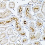 Immunohistochemistry - Anti-SGLT2 Antibody (A308462) - Antibodies.com