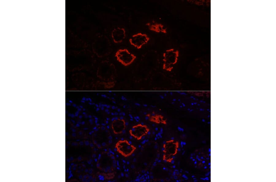 Immunofluorescence - Anti-SGLT2 Antibody (A308462) - Antibodies.com