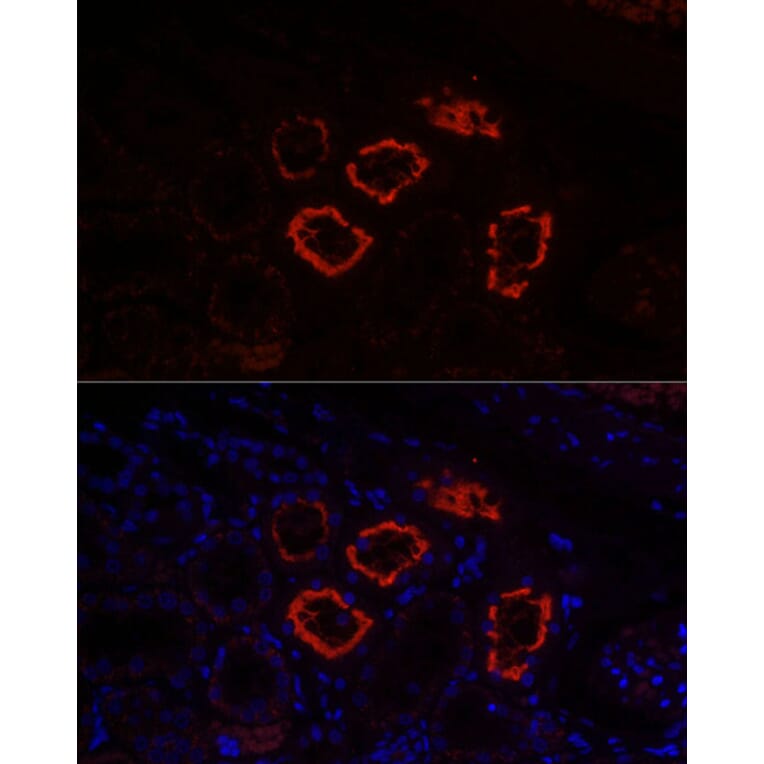 Immunofluorescence - Anti-SGLT2 Antibody (A308462) - Antibodies.com