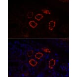 Immunofluorescence - Anti-SGLT2 Antibody (A308462) - Antibodies.com