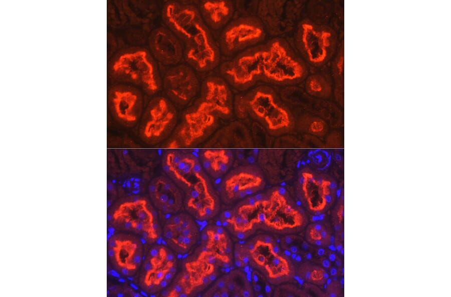 Immunofluorescence - Anti-SGLT2 Antibody (A308462) - Antibodies.com