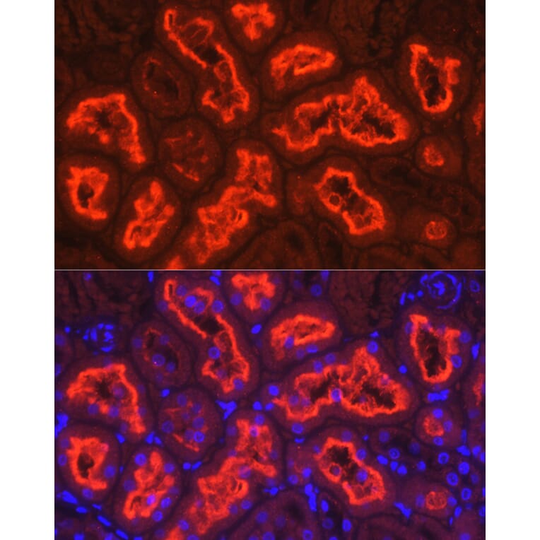 Immunofluorescence - Anti-SGLT2 Antibody (A308462) - Antibodies.com