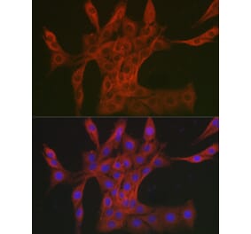Immunofluorescence - Anti-DAB2IP Antibody (A308464) - Antibodies.com
