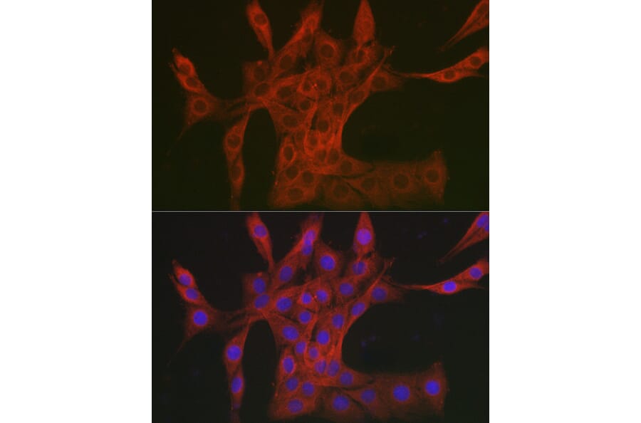 Immunofluorescence - Anti-DAB2IP Antibody (A308464) - Antibodies.com