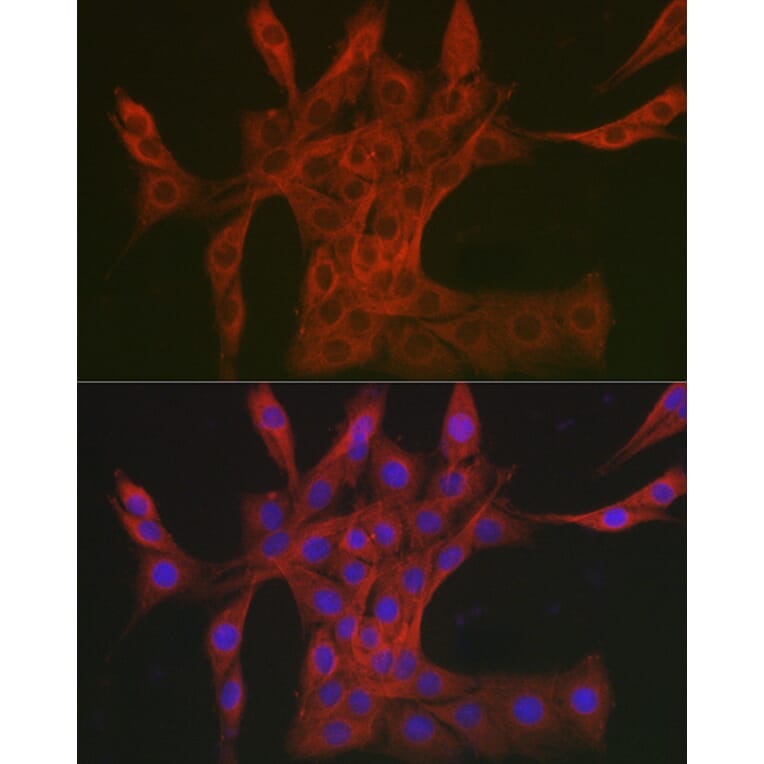Immunofluorescence - Anti-DAB2IP Antibody (A308464) - Antibodies.com
