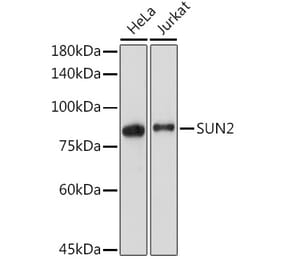Western Blot - Anti-SUN2 Antibody [ARC2311] (A308466) - Antibodies.com
