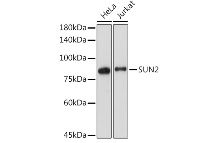 Western Blot - Anti-SUN2 Antibody [ARC2311] (A308466) - Antibodies.com