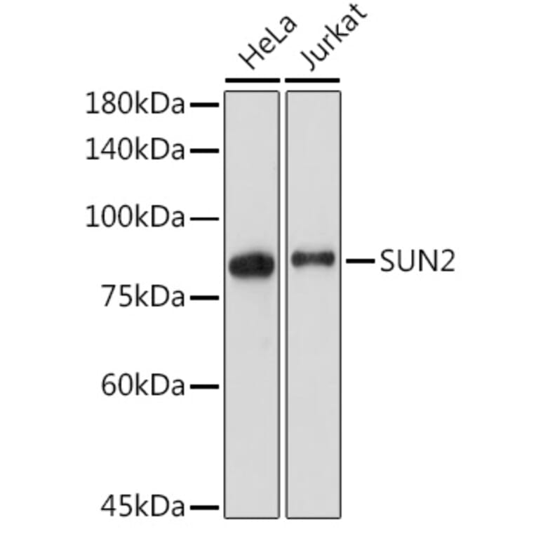 Western Blot - Anti-SUN2 Antibody [ARC2311] (A308466) - Antibodies.com