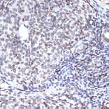 Immunohistochemistry - Anti-SUN2 Antibody [ARC2311] (A308466) - Antibodies.com