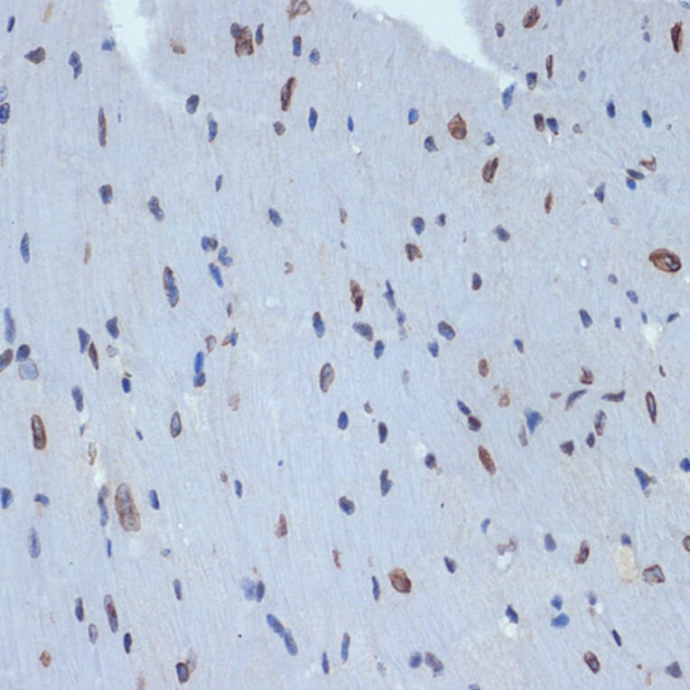 Immunohistochemistry - Anti-SUN2 Antibody [ARC2311] (A308466) - Antibodies.com