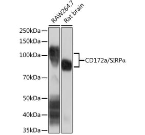 Western Blot - Anti-SIRP alpha Antibody [ARC1626] (A308467) - Antibodies.com