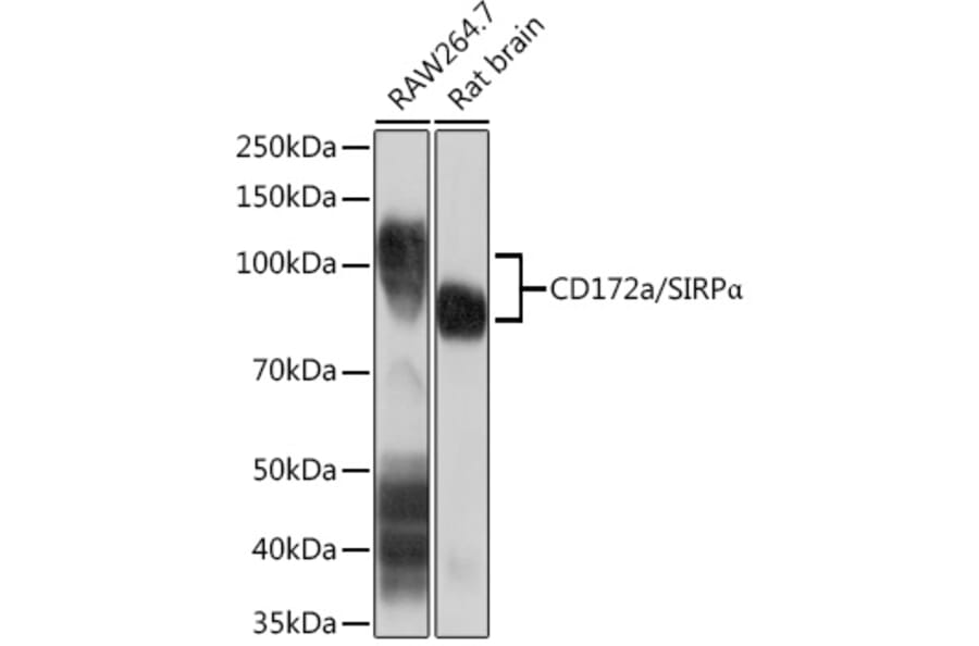 Western Blot - Anti-SIRP alpha Antibody [ARC1626] (A308467) - Antibodies.com