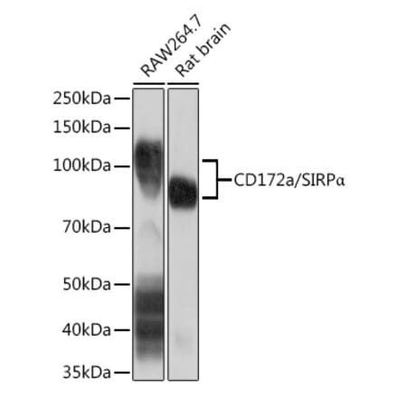 Western Blot - Anti-SIRP alpha Antibody [ARC1626] (A308467) - Antibodies.com