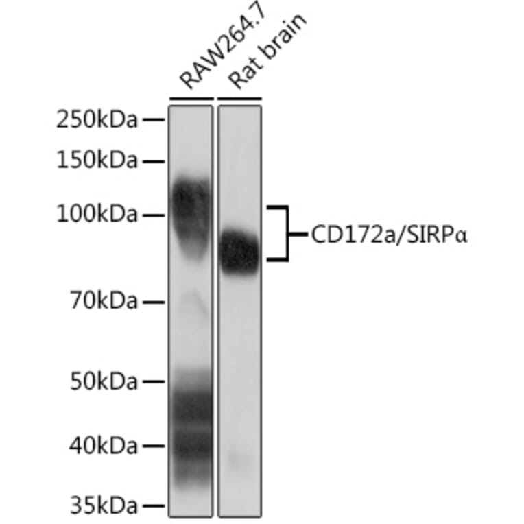 Western Blot - Anti-SIRP alpha Antibody [ARC1626] (A308467) - Antibodies.com