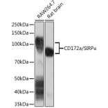 Western Blot - Anti-SIRP alpha Antibody [ARC1626] (A308467) - Antibodies.com