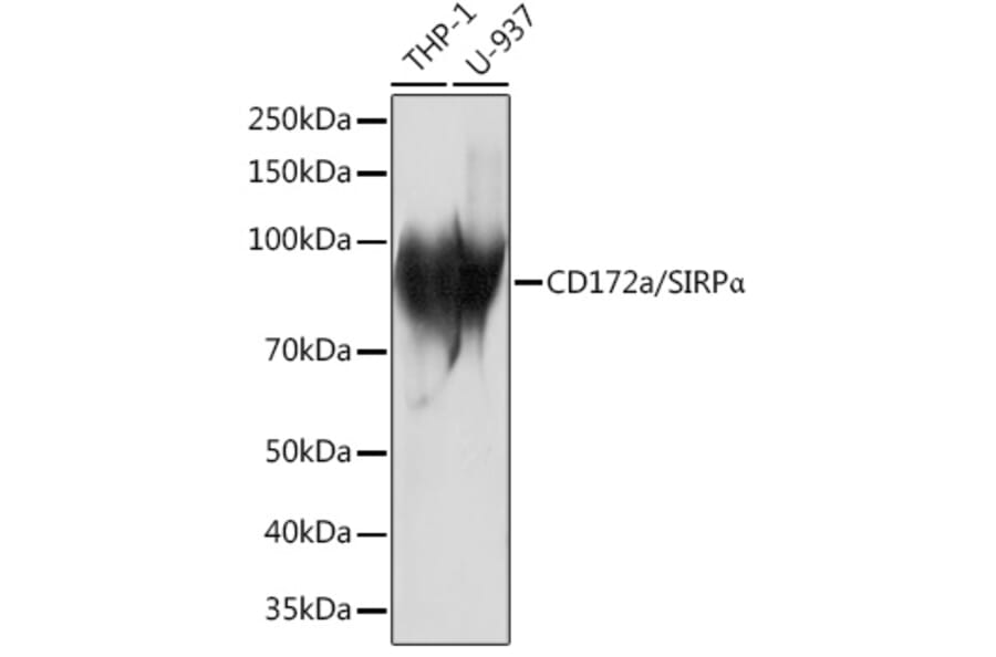 Western Blot - Anti-SIRP alpha Antibody [ARC1626] (A308467) - Antibodies.com
